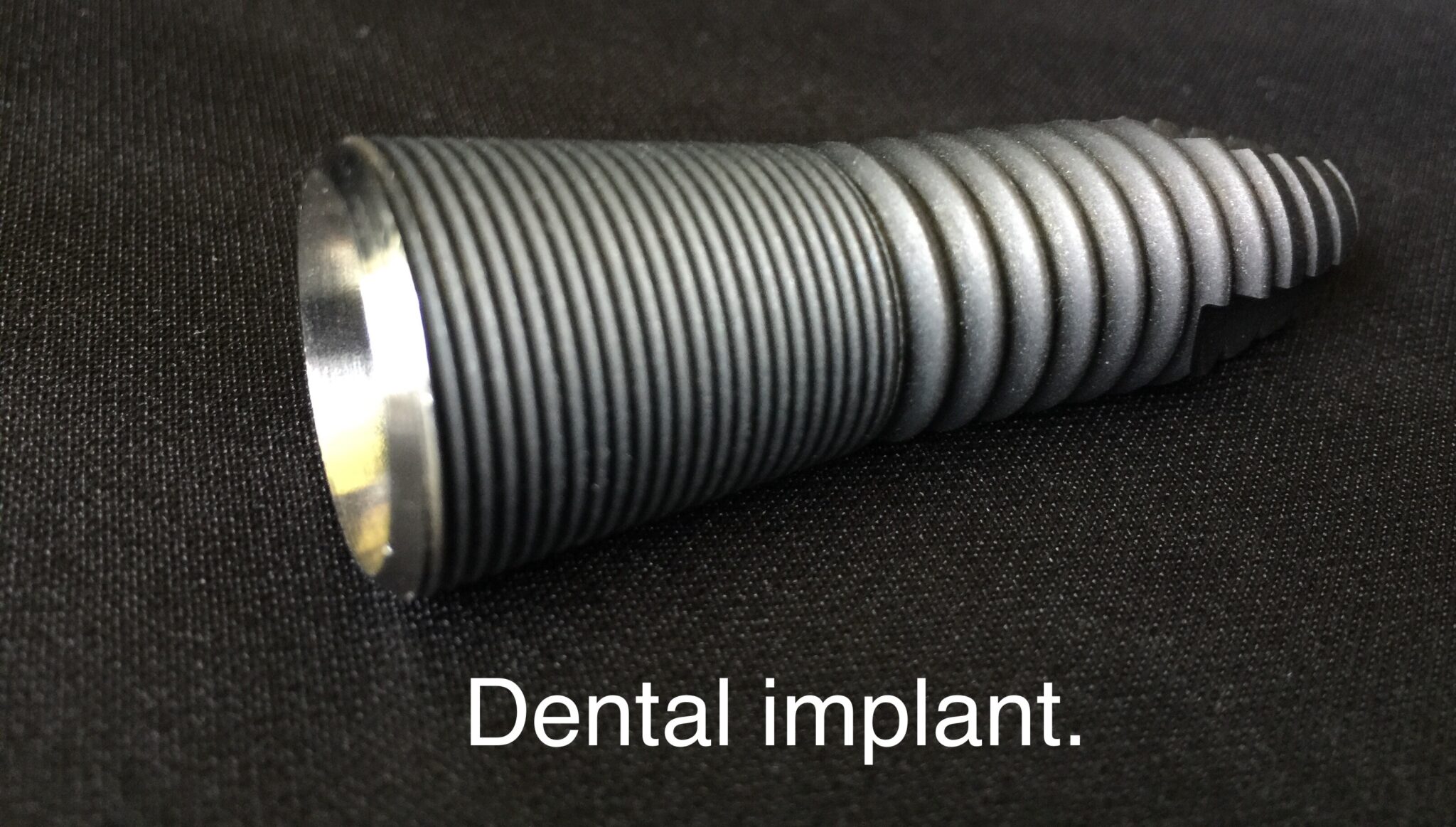 Breaking Down Dental Implants Pike Lake Dental